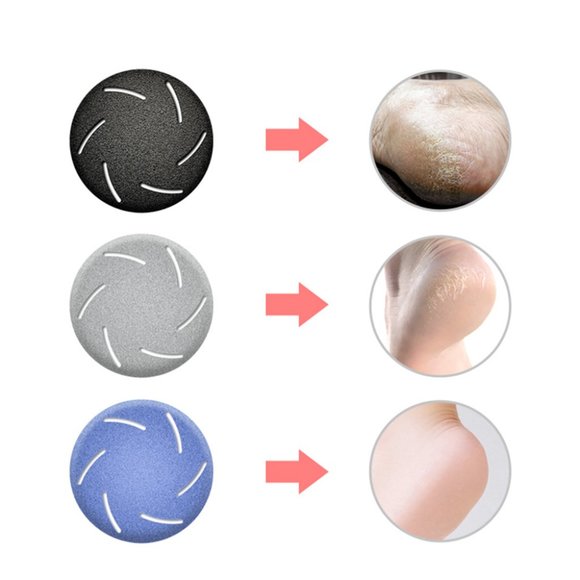 High Quality Callus remover Electric Rechargeable Foot Scrubber Pedicure Tools - Picture 10 of 11